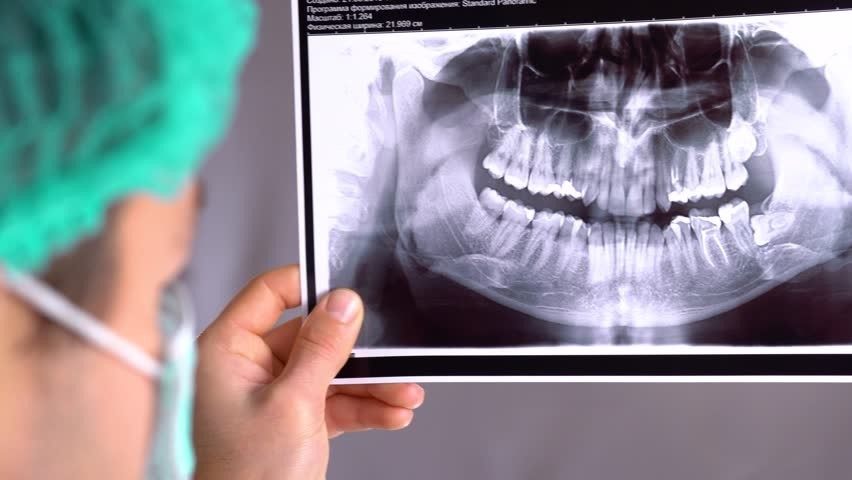 نحوه عکس برداری دندان با دستگاه OPG