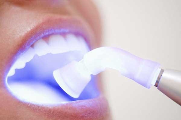 مزایای استفاده از لیزر در دندان پزشکی
