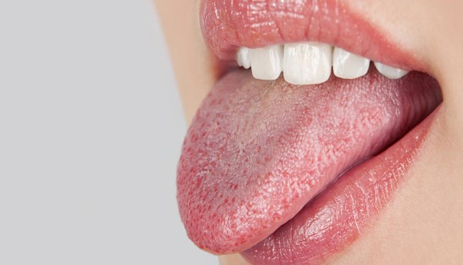کمبود کدام ویتامین باعث خشکی دهان می شود؟