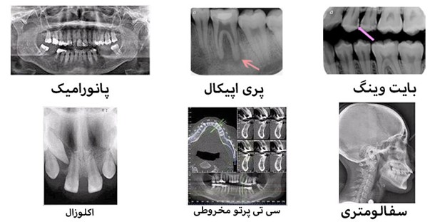 انواع عکس دندان